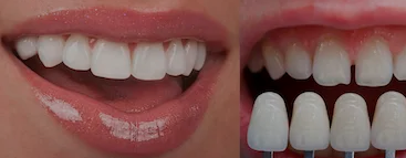estetike-dentare